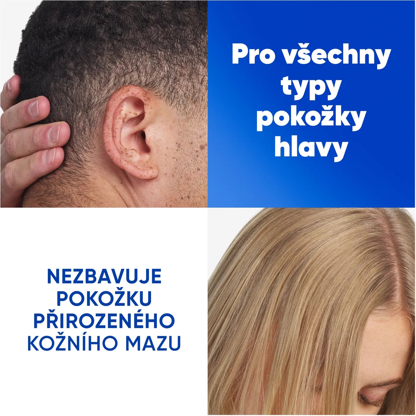 Head & Shoulders vlasový šampon proti lupům citrus fresh  500 ml