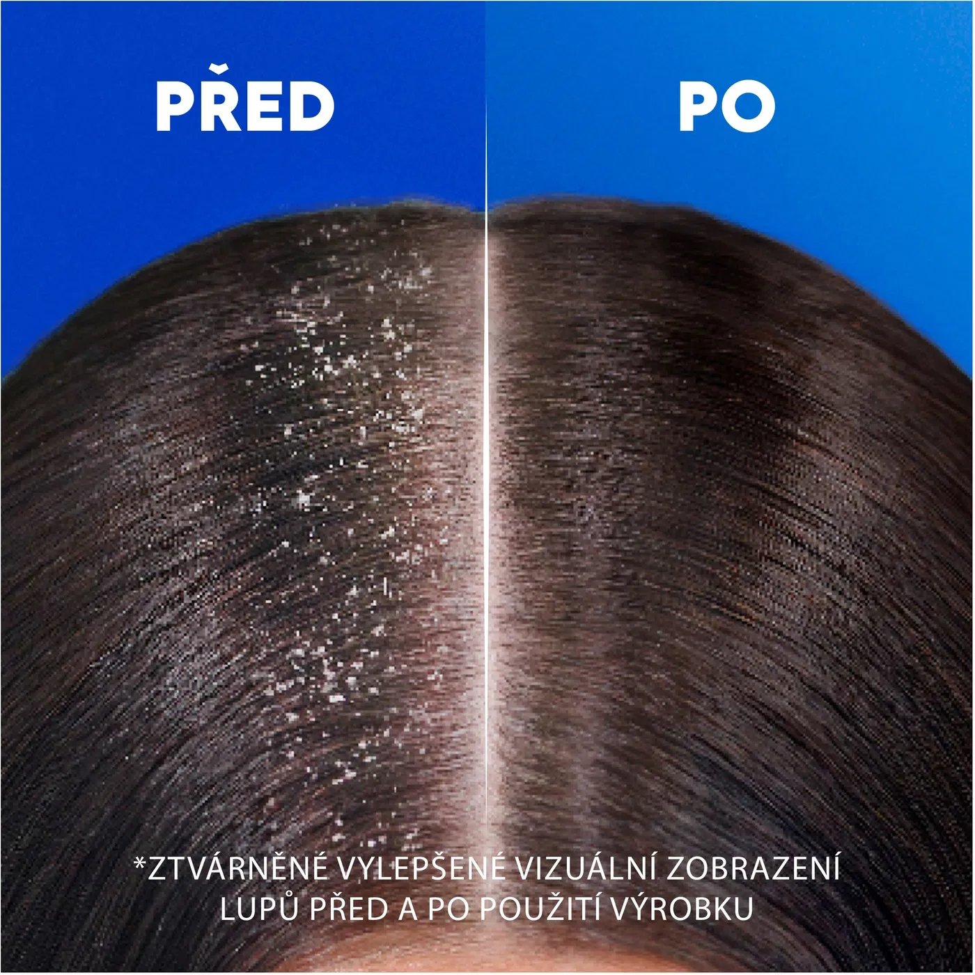 Head & Shoulders vlasový šampon proti lupům citrus fresh  500 ml